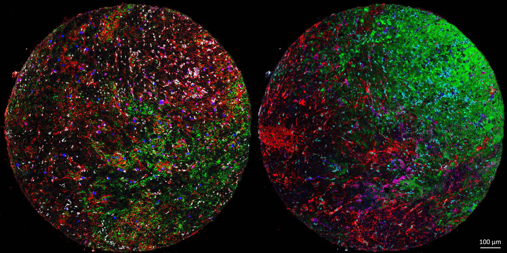 Mouse Oncology Spatial Imagery